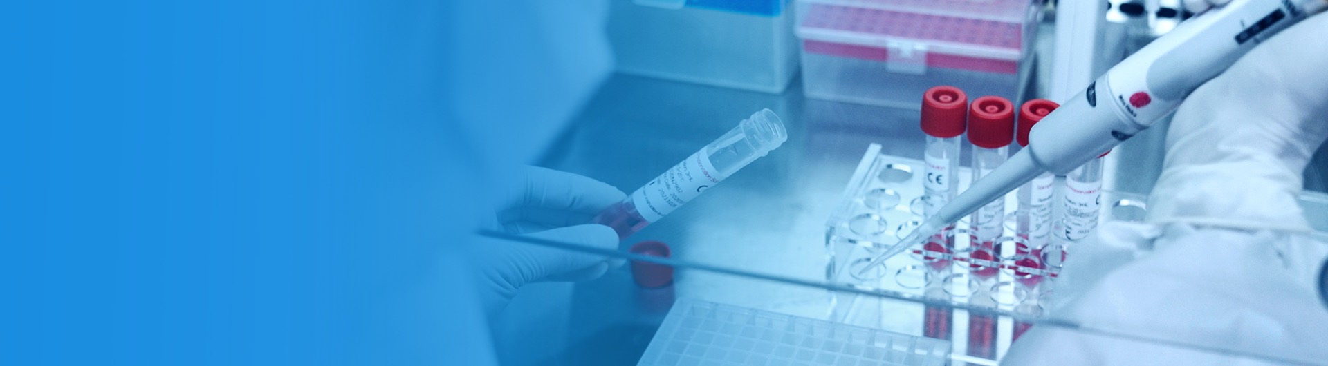Hurtigt testkit