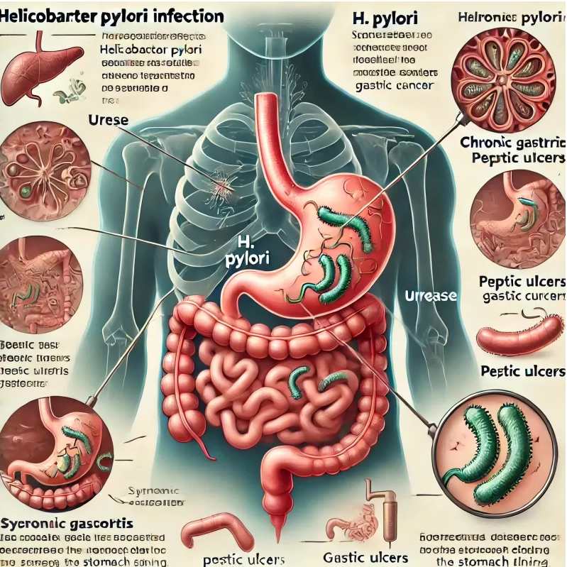 H. Pylori -test blev gjort enkel: Din løsning til hurtig og pålidelig diagnose