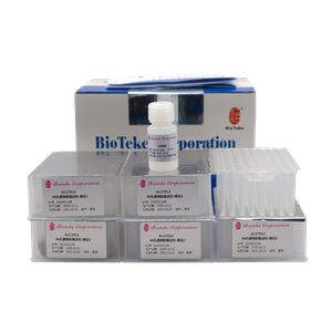 AU17011/17012 Udpakket viral DNA RNA Nucleic Acid Extraction Kit (Magnetic perles)