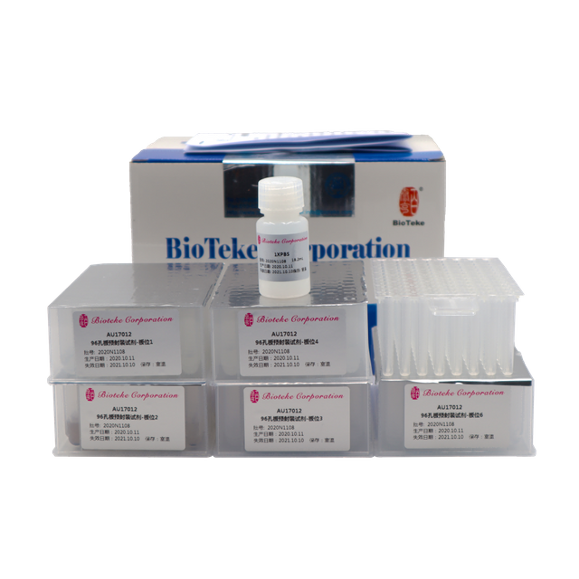 AU17011/17012 Udpakket viral DNA RNA Nucleic Acid Extraction Kit (Magnetic perles)